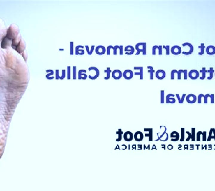 Noa 3 Lopera escort