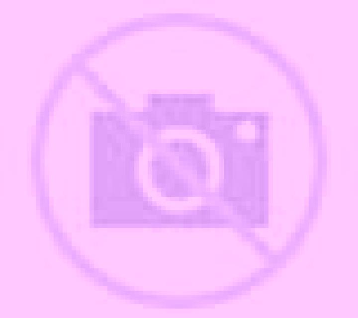 Noa 3 Tejadillos escort